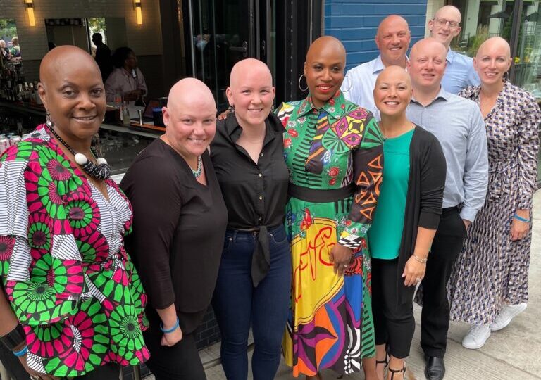 How to Support People With Alopecia